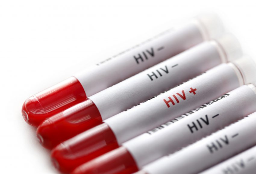 fiolki z krwią i napsem hiv