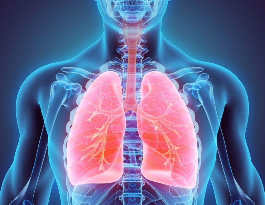 Graficzne przedstawienie zmian w płucach przy nadciśnieniu płucnym
