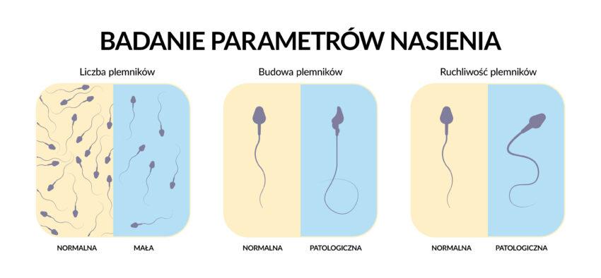 Schemat przedstawiające podstawowe parametry badania nasienia: liczbę plemników, ich budowę oraz ruchliwość.