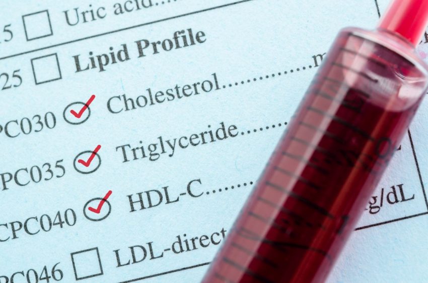 Mierzenie normy cholesterolu we krwi