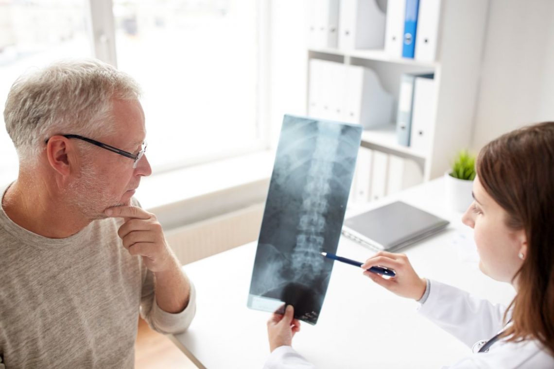 Lekarz pokazuje mężczyźnie zdjęcie rentgenowskie kręgoslupa