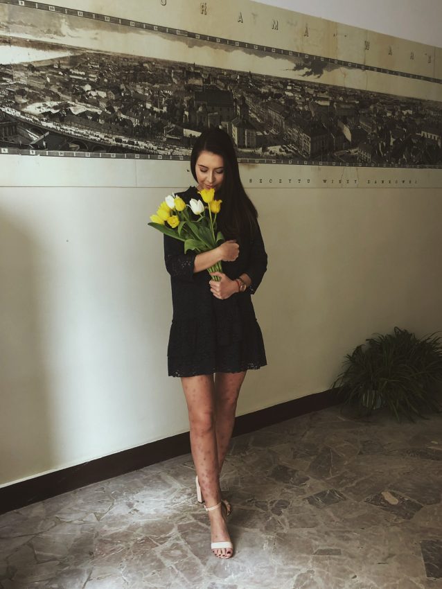 Tekst o Alicji, która otwarcie mówi o łuszczycy. Na zdjęciu: Kobieta trzymająca kwiaty przed ścianą - HelloZdrowie