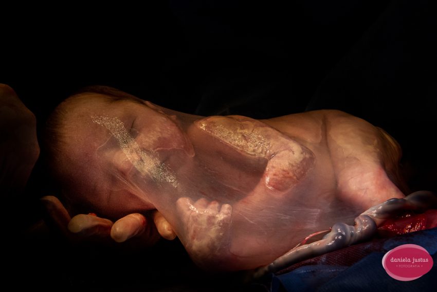 Tekst o konkursie fotografii porodowej i nagrodzonych zdjęciach. Na zdjęciu: Dziecko w ręce - HelloZdrowie