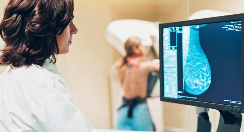 Kobieta na badaniu piersi metodą mammografii