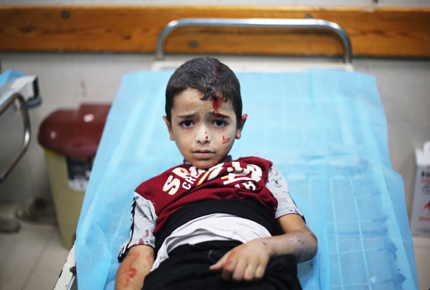 Ranne dziecko z Palestyny