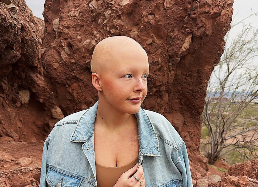 Madison Baloy zmagająca się z nowotworem- HelloZdrowie