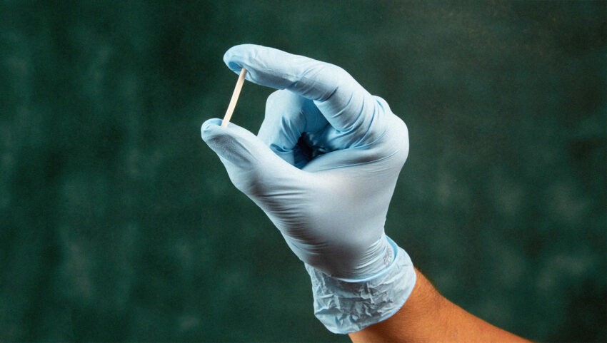 Implant antykoncepcyjny 4 cm długości oraz 2 mm szerokości