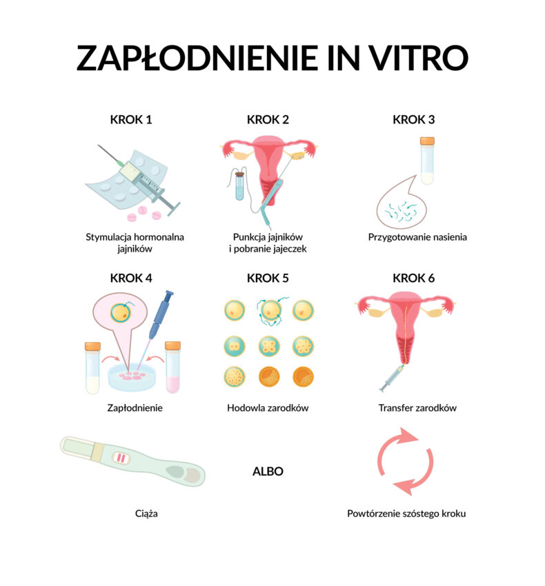 Na zdjęciu schemat zapłodnienia in vitro.